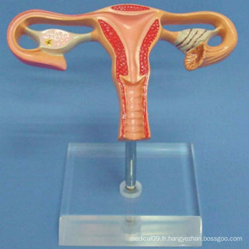 Modèle d&#39;anatomie de l&#39;utérus naturel humain pour l&#39;enseignement médical (R110218)